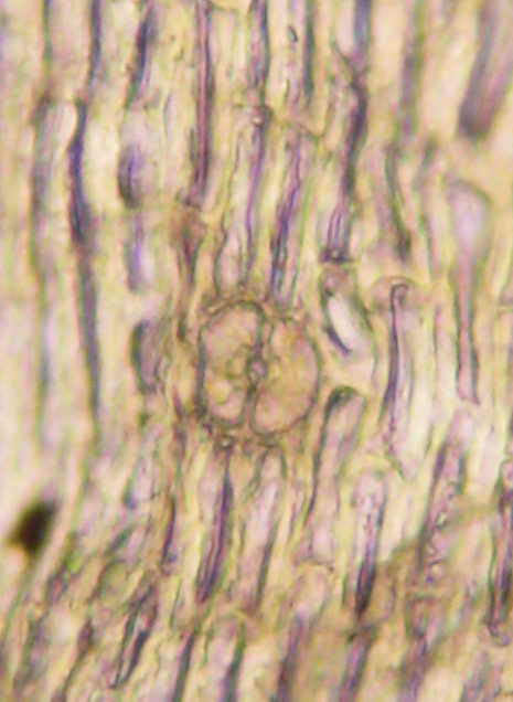Lewinskya elegans